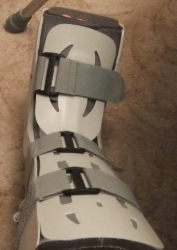 broken_ankle