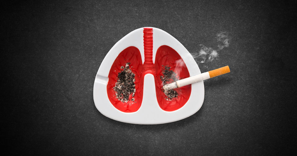 lung cancer and smoking