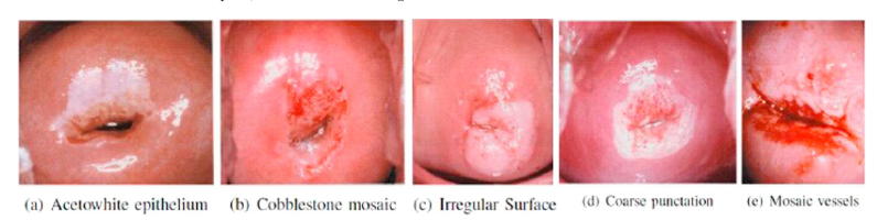 cervical diseases